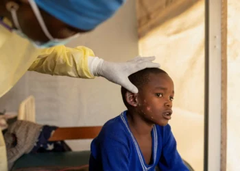 Sweden confirms 1st case of deadly mpox strain outside Africa