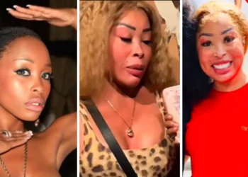 Khanyi Mbau’s “Painful” New Face Has Mzansi Gasping — What Did She Do?!