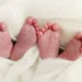 Rare Case: Limpopo Mother Gives Birth To Conjoined Twin Boys